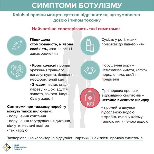ботулізм